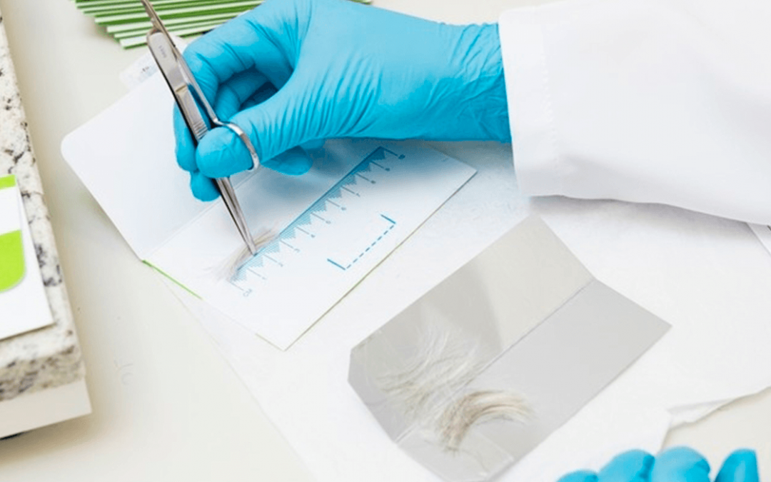 Você sabe como é feito o Exame Toxicológico?